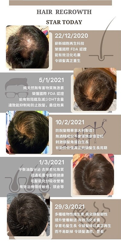 HairyFarm 的防脫生髪的產品，我們嚴選的成份均獲得美國食品藥品管理局所頒發的FDA認證
