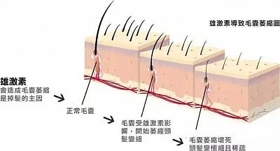 身形同髮型，唔通真係要二揀一