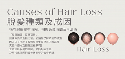 要挽救脫髮，首先了解成因，搵正確方法，及早治療