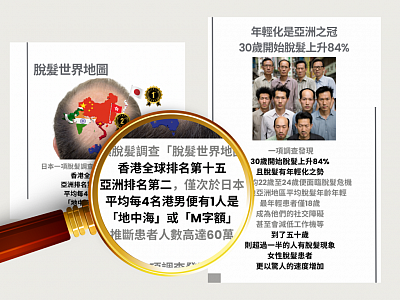 香港平均4個便有1個人有脱髪困擾